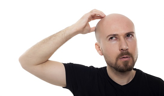 自毛植毛のFUT法とFUE法の違い